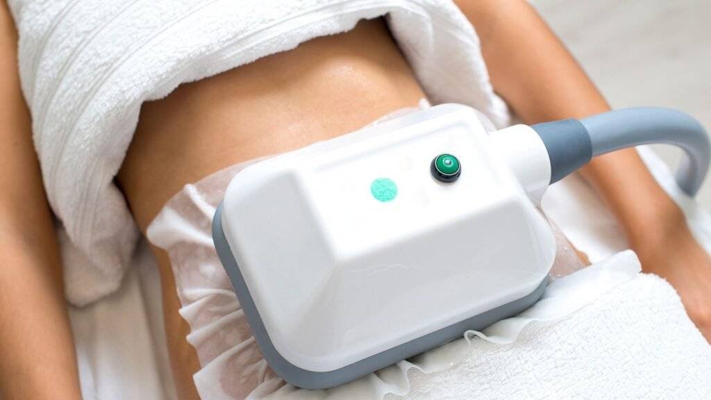 Coolsculpt Cryolipolysis