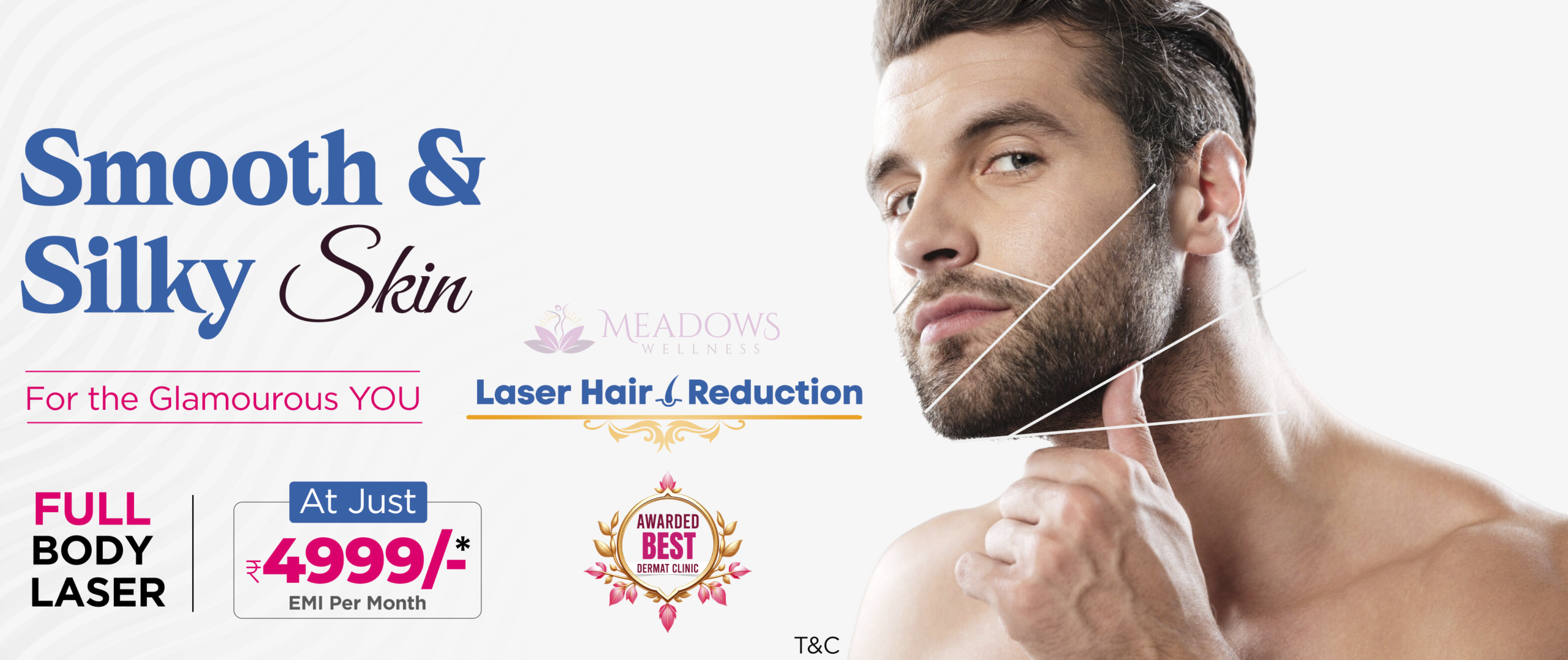 Laser Hair Removal